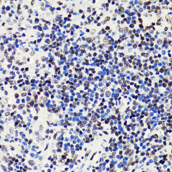 Acetyl-Histone H2B-K5 Rabbit pAb