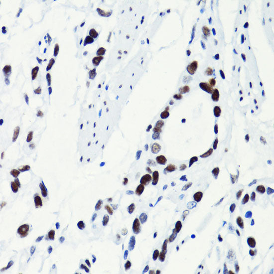 Acetyl-Histone H2B-K5 Rabbit pAb