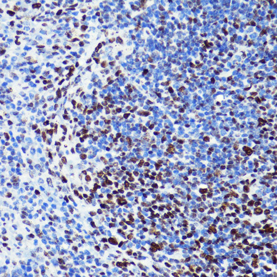 Acetyl-Histone H2B-K5 Rabbit pAb