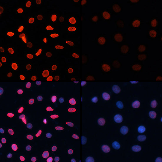 Acetyl-Histone H2B-K5 Rabbit pAb