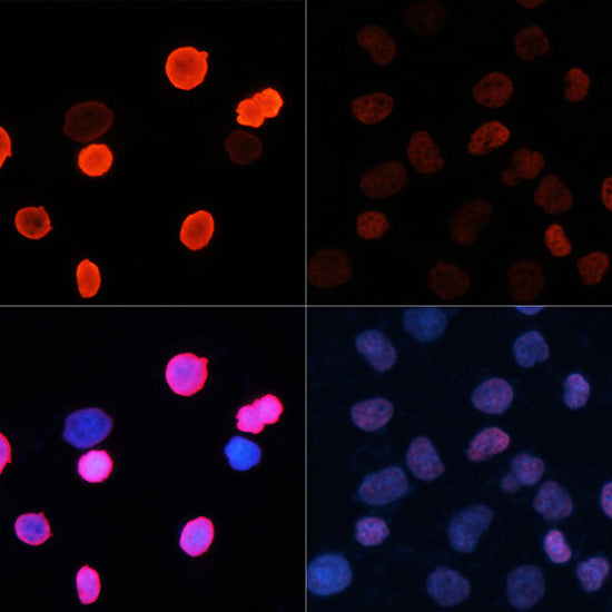 Acetyl-Histone H2B-K5 Rabbit pAb