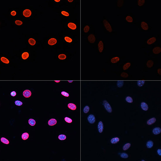 Acetyl-Histone H2B-K5 Rabbit pAb