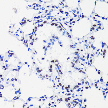 Acetyl-Histone H2B-K15 Rabbit pAb