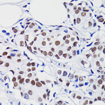 Acetyl-Histone H2B-K15 Rabbit pAb