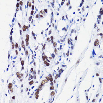 Acetyl-Histone H2B-K15 Rabbit pAb