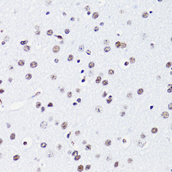 Acetyl-Histone H2B-K15 Rabbit pAb