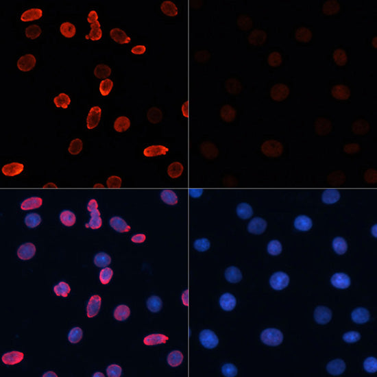 Acetyl-Histone H2B-K15 Rabbit pAb