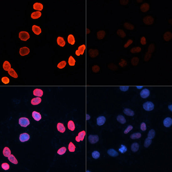 Acetyl-Histone H2B-K15 Rabbit pAb