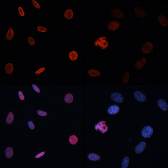 Acetyl-Histone H2B-K15 Rabbit pAb