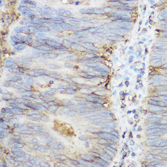 beta 2 Microglobulin Rabbit pAb