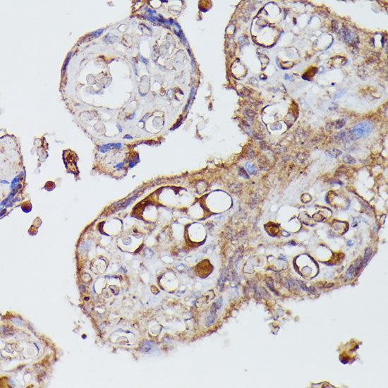 Angiotensinogen Rabbit pAb