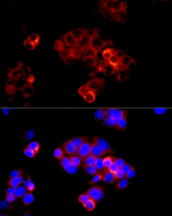 Angiotensinogen Rabbit pAb
