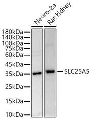 ANT2/SLC25A5 Rabbit pAb
