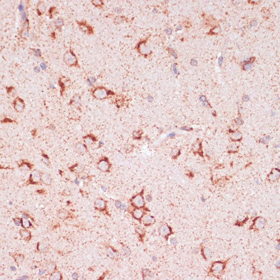 ENTPD6 Rabbit pAb