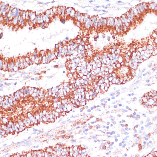 ENTPD6 Rabbit pAb