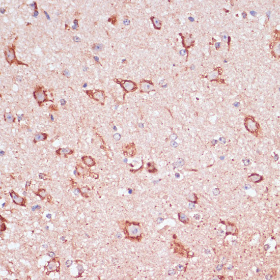 ENTPD6 Rabbit pAb