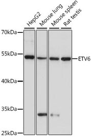 ETV6 Rabbit pAb