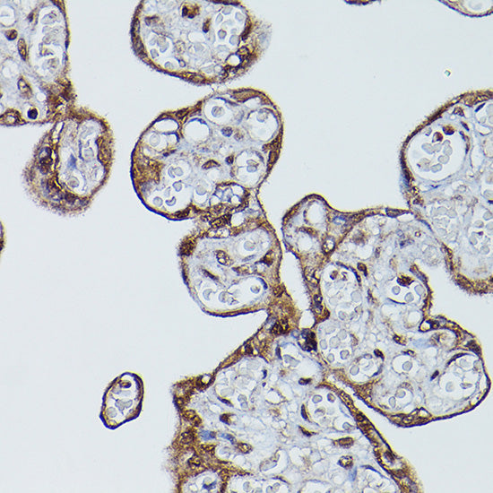 CD147/BSG Rabbit pAb