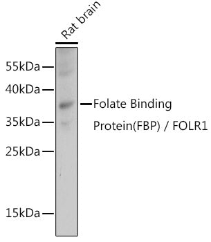 Folate Binding Protein(FBP) / FOLR1 Rabbit pAb