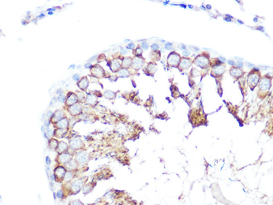 Folate Binding Protein(FBP) / FOLR1 Rabbit pAb