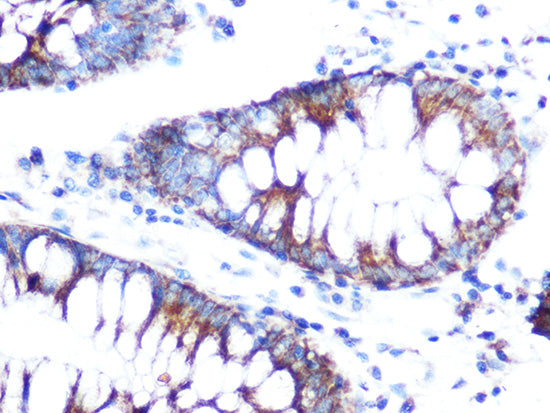 Folate Binding Protein(FBP) / FOLR1 Rabbit pAb