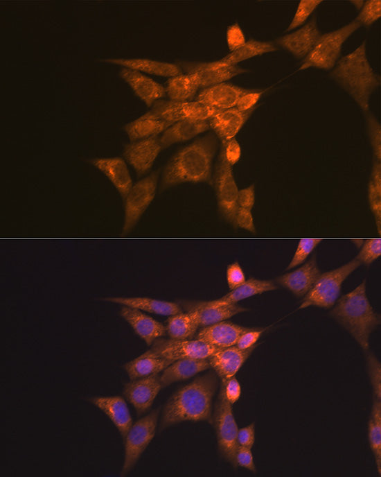 Folate Binding Protein(FBP) / FOLR1 Rabbit pAb