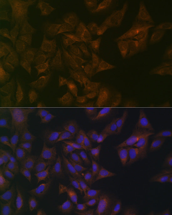 Folate Binding Protein(FBP) / FOLR1 Rabbit pAb
