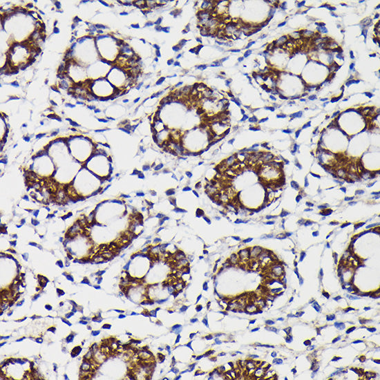 Monoamine Oxidase B (MAOB) Rabbit pAb