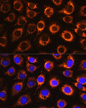 Monoamine Oxidase B (MAOB) Rabbit pAb