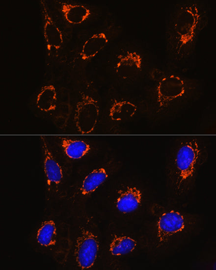 Monoamine Oxidase B (MAOB) Rabbit pAb