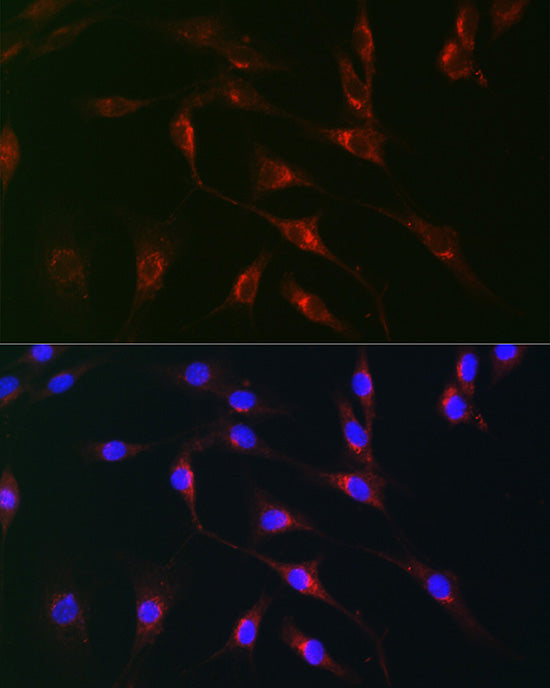 Monoamine Oxidase B (MAOB) Rabbit pAb