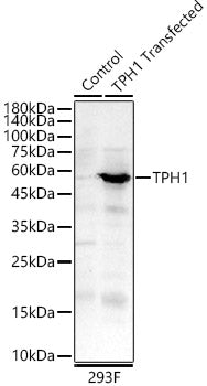 TPH1 Rabbit pAb