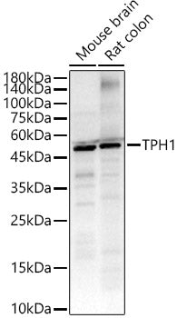 TPH1 Rabbit pAb