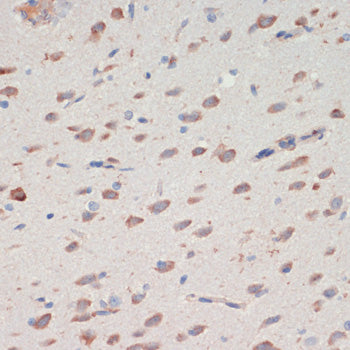 SERPINI1 Rabbit pAb