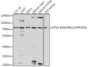 PP2A-B56δ/PR61δ/PPP2R5D Rabbit pAb