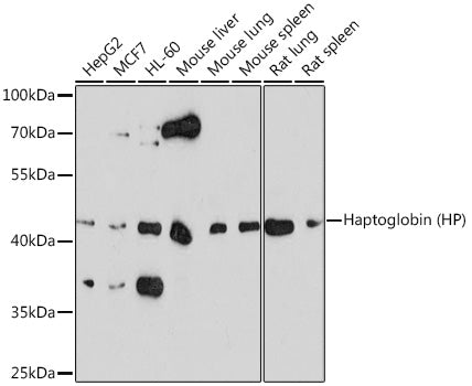 Haptoglobin (HP) Rabbit pAb