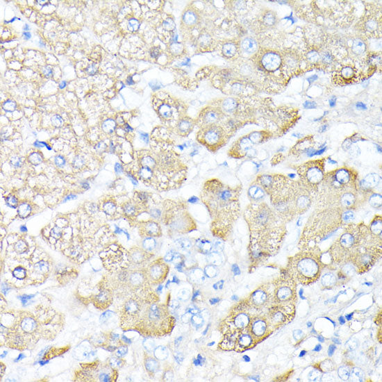 Haptoglobin (HP) Rabbit pAb