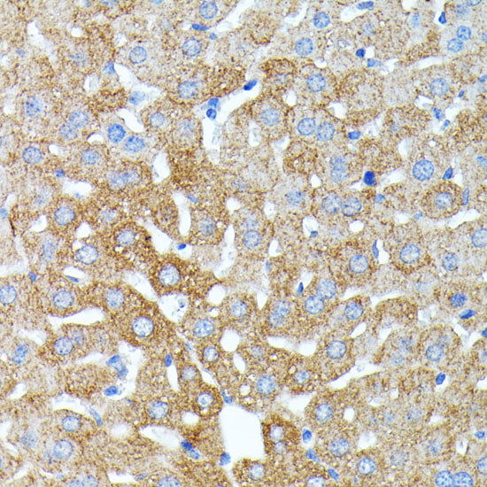 Haptoglobin (HP) Rabbit pAb