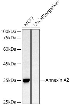 Annexin A2 Rabbit pAb