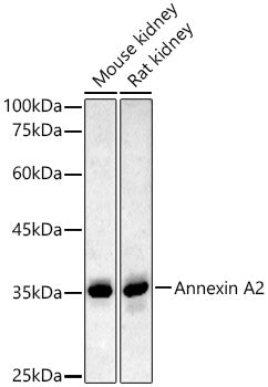 Annexin A2 Rabbit pAb