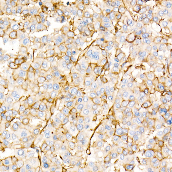Annexin A2 Rabbit pAb