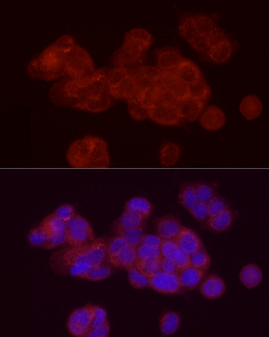 Annexin A2 Rabbit pAb