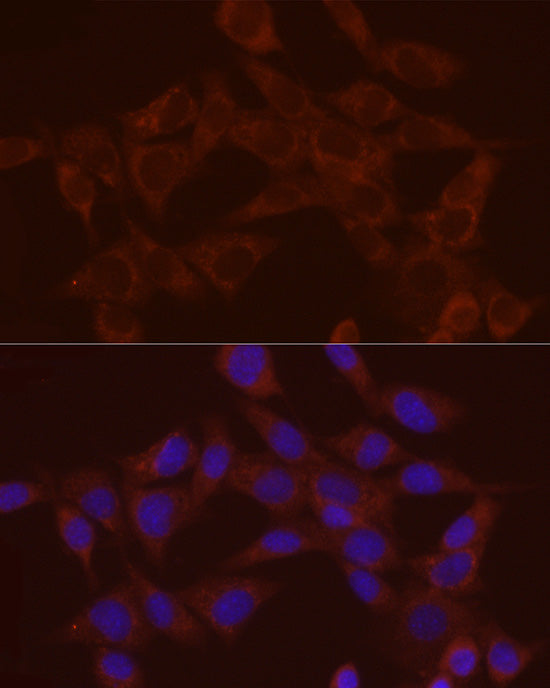 Annexin A2 Rabbit pAb