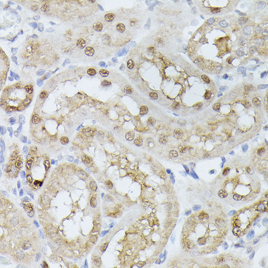 TPI1 Rabbit pAb