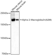 Alpha-2-Macroglobulin (A2M) Rabbit pAb