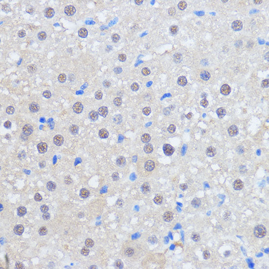 RBM39 Rabbit pAb