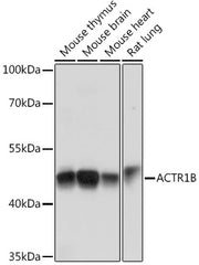ACTR1B Rabbit pAb