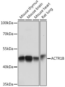 ACTR1B Rabbit pAb