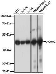ACAA2 Rabbit pAb