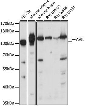 AVIL Rabbit pAb